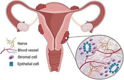 Endometriosis-Associated Macrophages: Origin, Phenotype, and Function